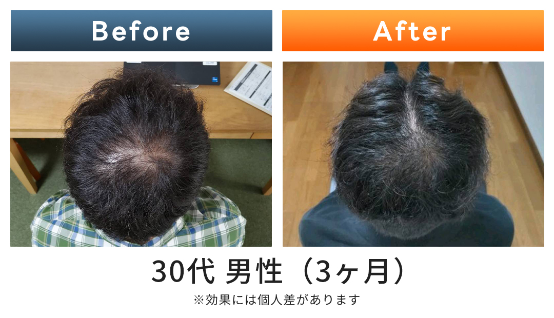 ビフォーアフター